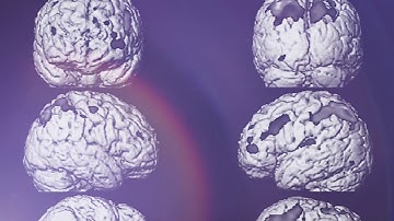 AI Profiling the Patient