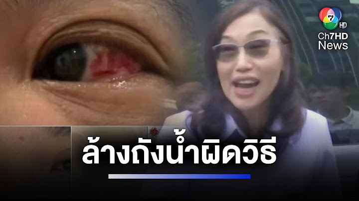ลงพื้นที่ตรวจถังบรรจุน้ำคอนโดฯ เจอปรสิต หลังทำลูกบ้านกว่า 70 คน เคืองตา | ห้องข่าวภาคเที่ยง