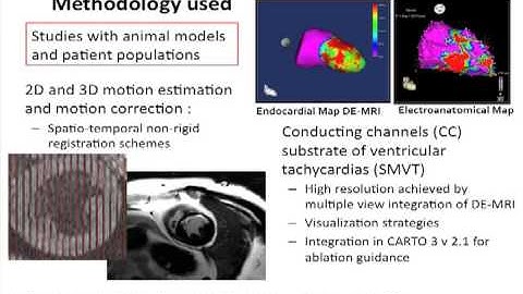 CMR Image Analysis for Myocardial Characterization - Maria Jesus Ledesma