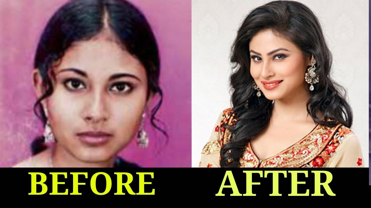 10 Plastic Surgery Of Popular TV Actresses BEFORE & AFTER 2018