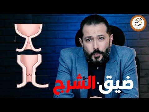 فيديو: هل التوسيع جزء مهم في عملية المعالجة؟