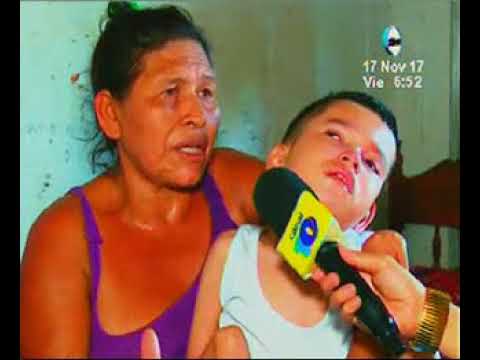 Hidrocefalia en un adolescente