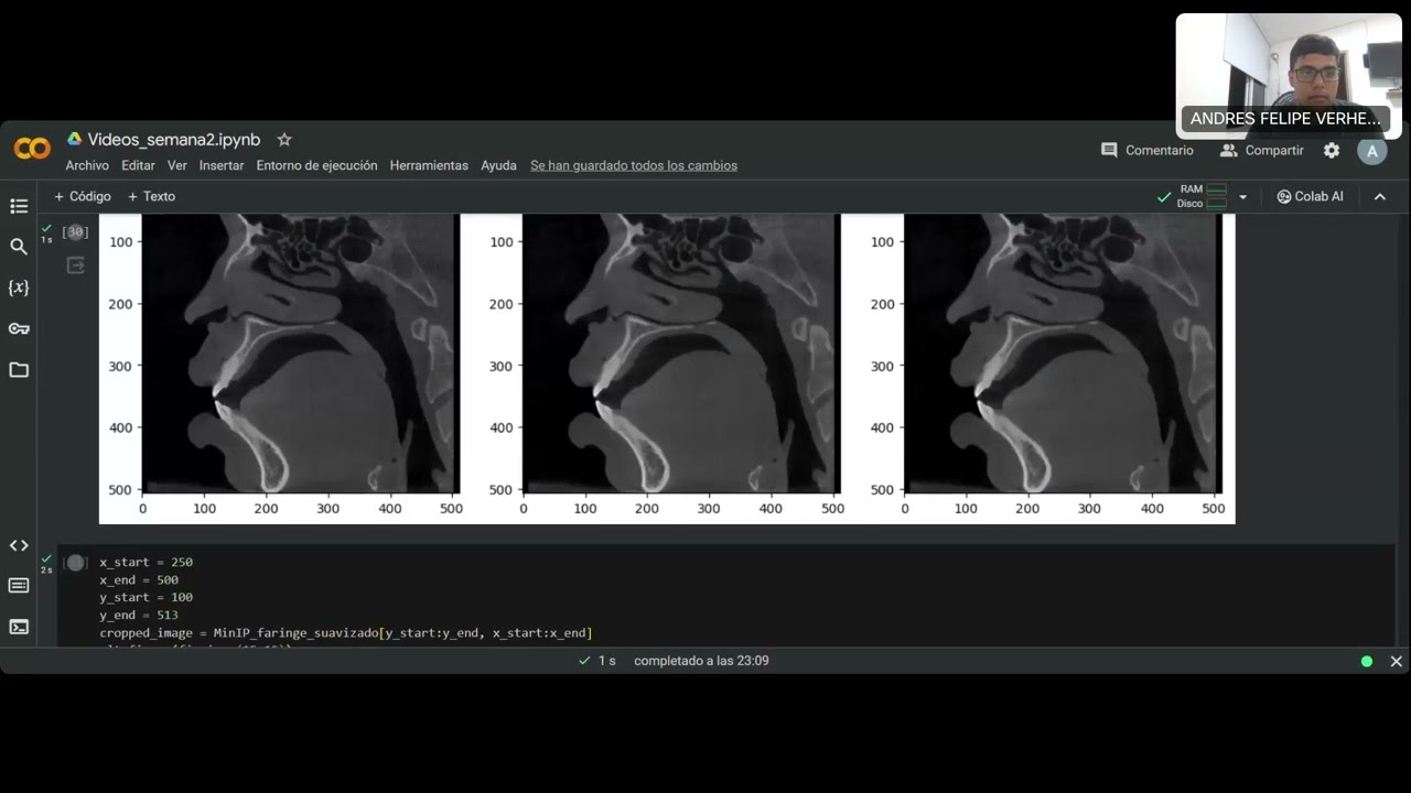 procesamientos imágenes pydicom PARTE 6