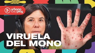 Alerta de la OMS: emergencia sanitaria internacional por la VIRUELA DEL MONO #DeAcáEnMás