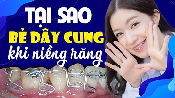 Tại Sao Phải Bẻ Dây Cung Khi Niềng Răng? | Nam Bui Vinalign