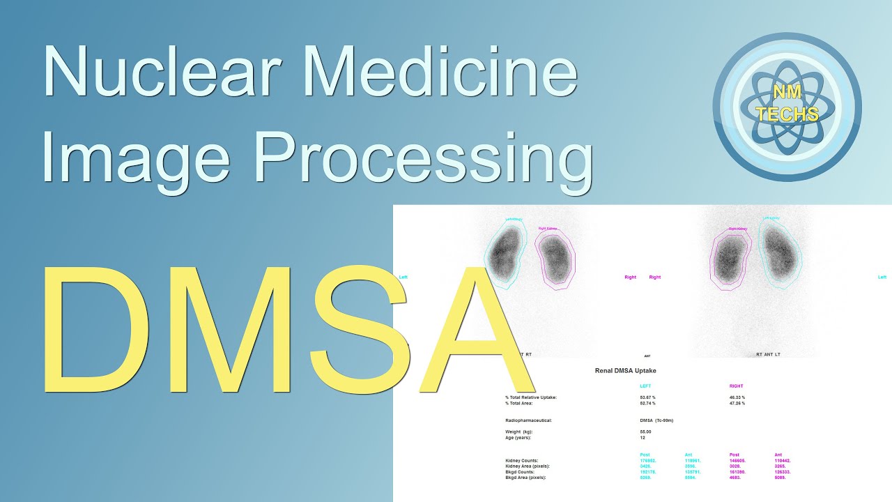 DMSA image Processing, in nuclear medicine - YouTube