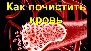 Чистим сосуды и кровь. Как очиститься и похудеть на 7 кг - мой опыт | #какпохудеть #edblack Чистим сосуды и кровь. Как очиститься и похудеть на 7 кг - мой опыт | #какпохудеть #edblack