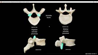 BIO 210 Lab Chapter 8 The Appendicular Skeleton Part 1 Ch 8 Appendicular Skeleton Part 1
