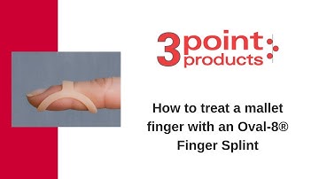 How to Treat a Mallet Finger with an Oval-8 Finger Splint - 3-Point Products