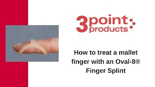 How to Treat a Mallet Finger with an Oval-8 Finger Splint - 3-Point Products