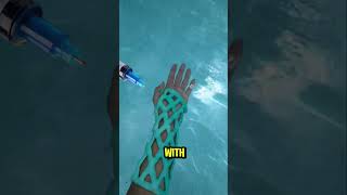 Broken Bones Might Never Use Casts Again