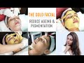 The Liquid Gold Facial Treatment To Reduce Pigmentation, Delay Skin Ageing & Boost Glow