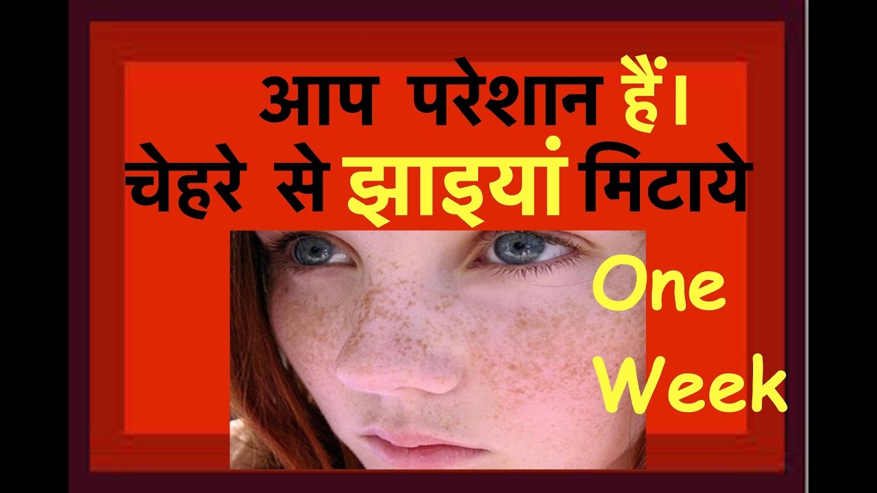 pigmentation-on-face-pigmentation-treatment-at-home-in-hindi