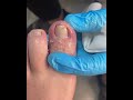 Satisfying Pedicure Routine | Gentle Toenail Care #fypシ #fypシ #pedicure #nailcare