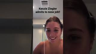 Kenzie Ziegler confirms nose job #kenzieziegler #dancemoms