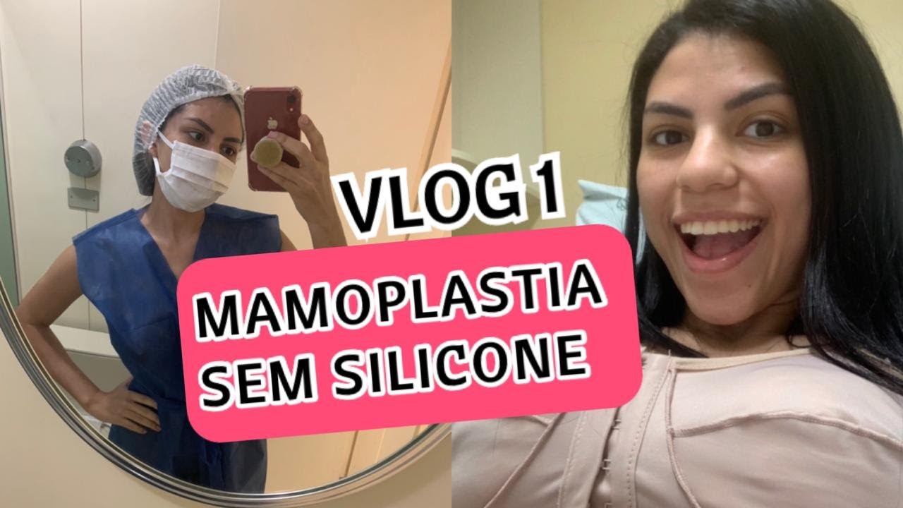 Quanto Tempo Demora Para Desinchar Apos Mamoplastia