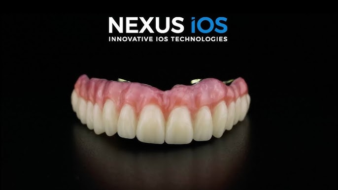 You can now digitally verify full-arch scans with Nexus Connect! The first  A.I enabled implant-scan alignment software. Full-arch scans…