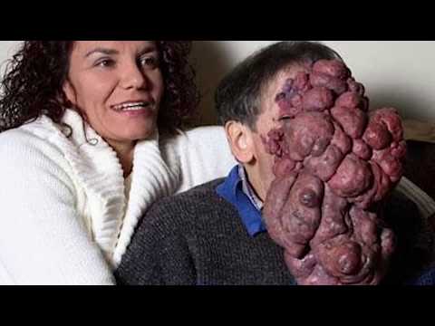 10 невероятных хирургических операций