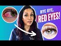 How To Get Rid Of Red Eyes Fast