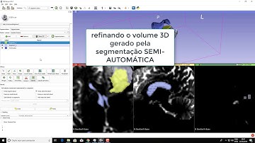 Projeto slicer 3D