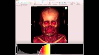 Osirix Tutorial #3