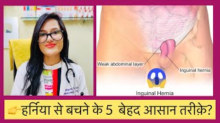 इंग्वनल हेर्निया? Best Homeopathic  Treatment For Inguinal Hernia- Top  5 Homeopathic Medicine?