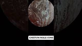 #botany gnetum male cone