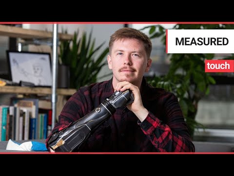 Man praises Open Bionics for "changing his life" | SWNS TV