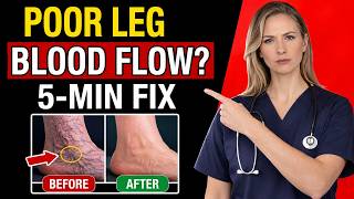 Poor Leg Circulation? 30-Second Test + 3 Fast Fix