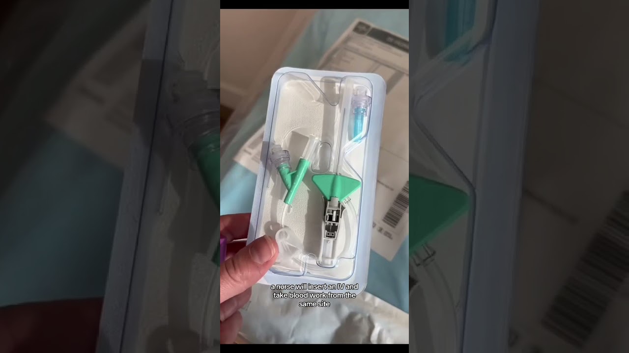 What to expect for a scheduled 