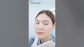 [TRỰC TIẾP] KẾT QUẢ SAU 60 PHÚT CĂNG DA NỘI SOI SMAS CỦA KHÁCH HÀNG U45