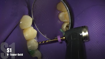 V-Taper Gold!