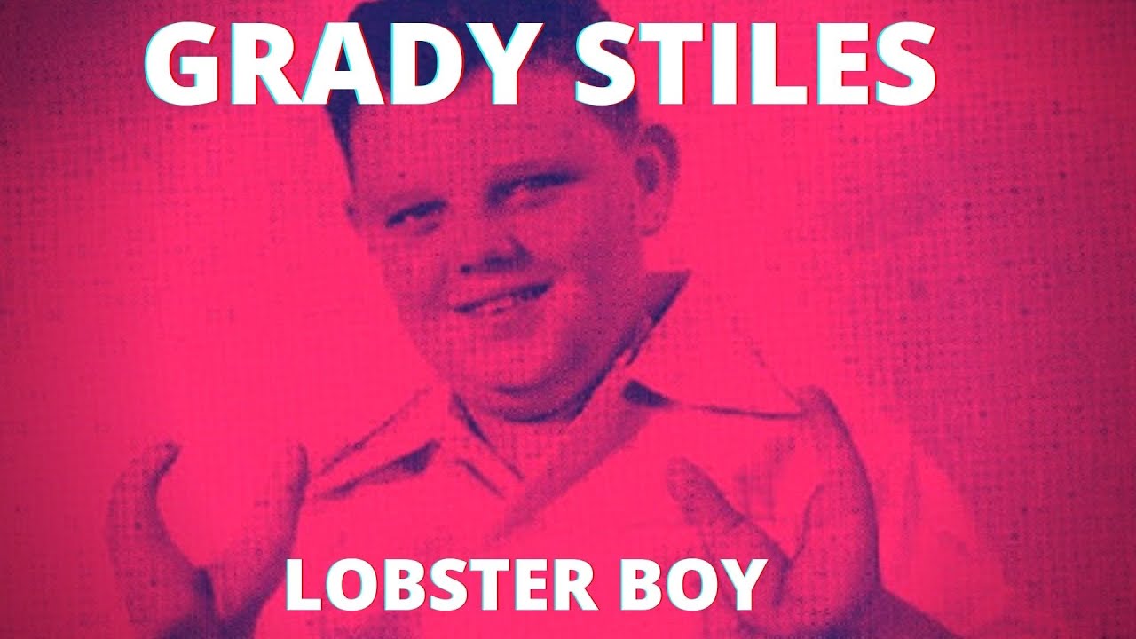 Grady Stiles Lobster Boy YouTube