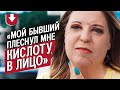 Меня облили серной кислотой: Таня | Быть молодым