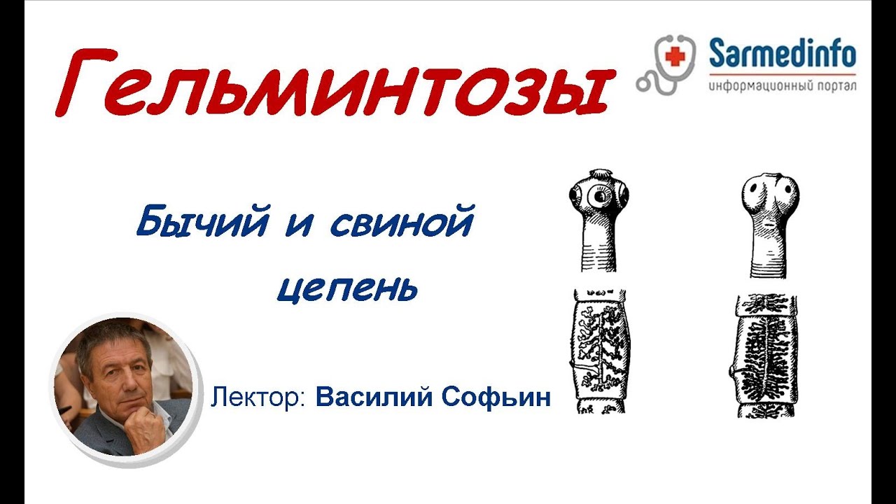 Гельминтозы | Бычий и свиной цепень