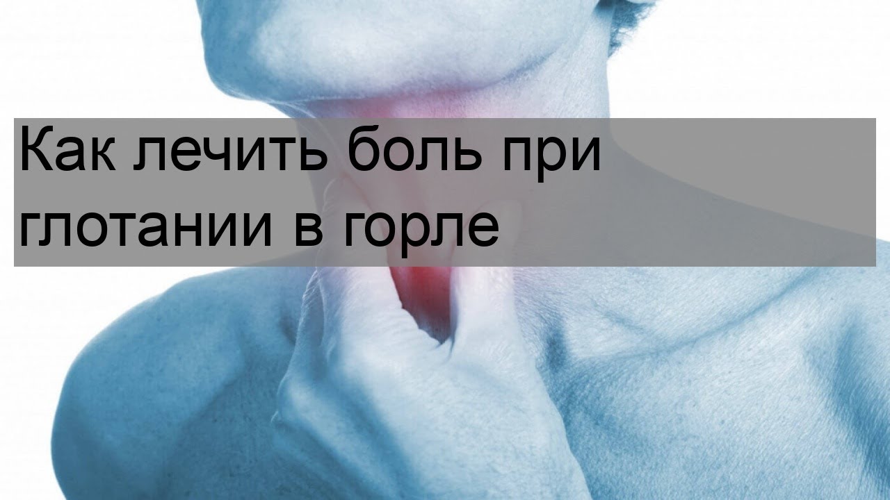 Боль в горле при глотании. Боль в гортани при глотании. Как глотать слюну если больно. Слюна при боли в горле