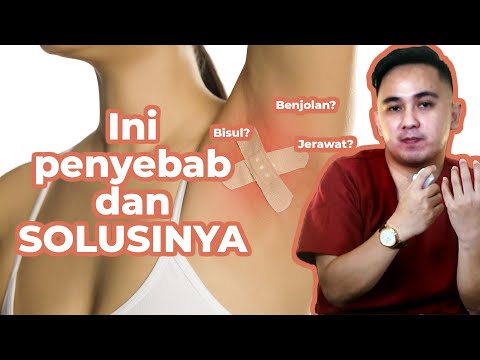 Benjolan di Ketiak ini Jerawat atau Bisul sih? Ini penjelasan lengkapnya!