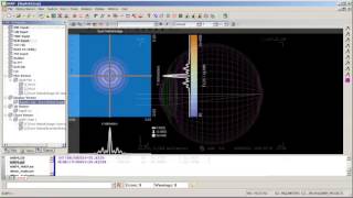 Intraocular Lens Simulation in Human Eye Model