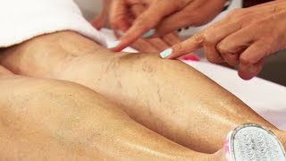 Varicosas? aceite oliva venas ¿Qué para hace el de las
