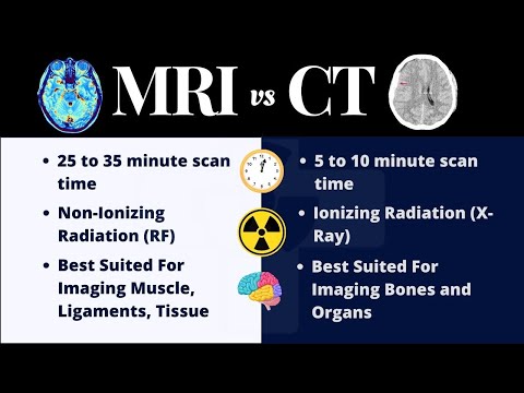 Video: Adakah als muncul di mri?