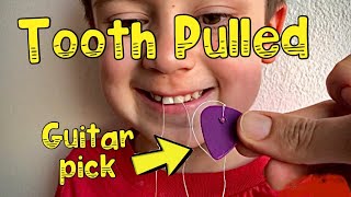 Tooth Pulled With a Guitar Pick