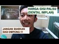 Pengalaman Implan Gigi - Solusi Untuk Gigi Ompong - Harga Implan Gigi