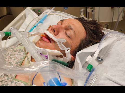 I feel like a train hit me Man shares miraculous story of survival after being hit by lightning
