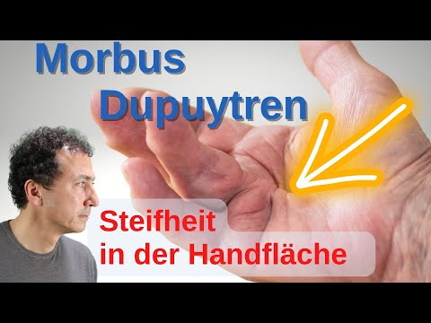 Video: Wie wird die Fasziotomie durchgeführt?