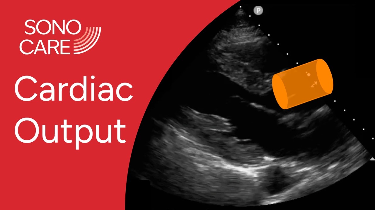How to Measure Cardiac Output