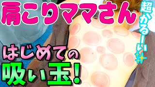 【吸い玉】肩こりママさんに吸い玉！アラフォーママさんであるセラピストのあやさんの肩こりは吸い玉で改善されるのでしょうか？【カッピング】