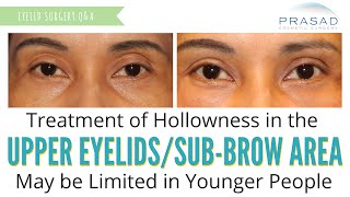 Treating Hollowness in Upper Eyelids - Common in Aging, Not Common in Young Skin