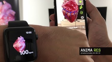 Medical Education #3D #MedicalAnimations #AppleWatch Insight Heart @animares