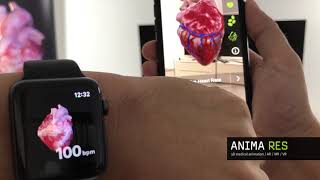 Medical Education #3D #MedicalAnimations #AppleWatch Insight Heart @animares