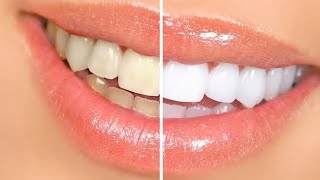 JINSI YA KUNGARISHA MENO UKIWA NYUMBANI